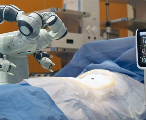 Artificial Intelligence Brings Precision and Insights to Computer-Assisted Surgery